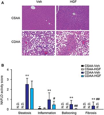 Interventional Potential of Recombinant Feline Hepatocyte Growth Factor in a Mouse Model of Non-alcoholic Steatohepatitis